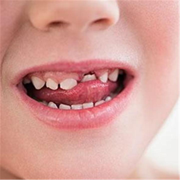 孩子坏牙掉了牙根还在,孩子坏牙换牙能好吗