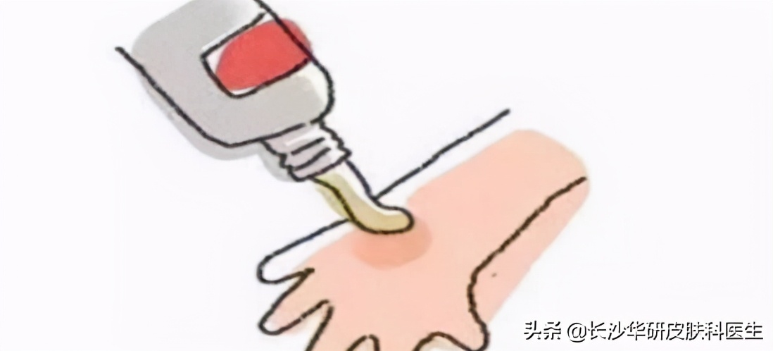 白癜风怎么治疗最快最见效,白癜风的治疗方法怎么治