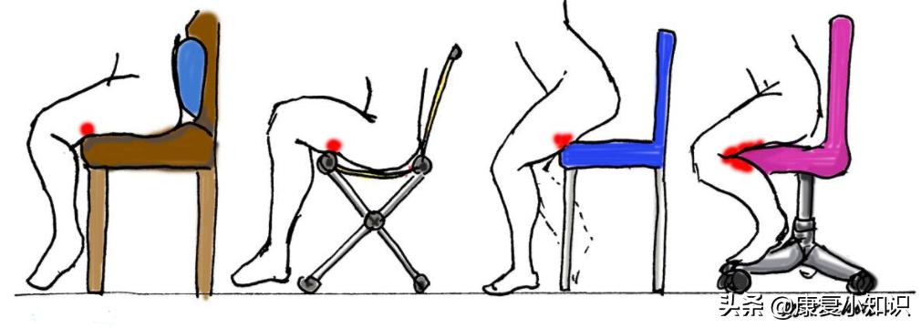 大腿后侧疼痛的位置图,大腿后侧根部疼痛