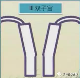 常见的几种子宫畸形诊断标准,先天性子宫畸形是什么原因造成的