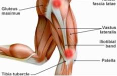 如何跑步才能避免髂胫束综合征,膝盖外侧髂胫束疼痛跑步怎么保护