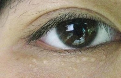 名门泽佳眼袋测评,名门泽佳修肤眼霜对眼袋有效果吗