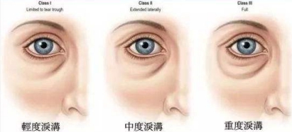 孕期可以使用兰蔻菁纯眼霜吗,孕期眼霜大牌推荐