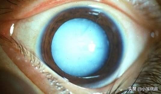 猫得了白内障怎么办,鸟得了白内障怎么办