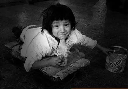 眼球被挖掉了还能恢复么,眼球被挖了一个洞还能恢复吗