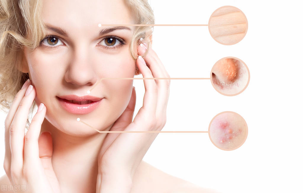 痘痘怎么形成的和饮食有关吗,脸颊两边痘痘红肿还反复长痘