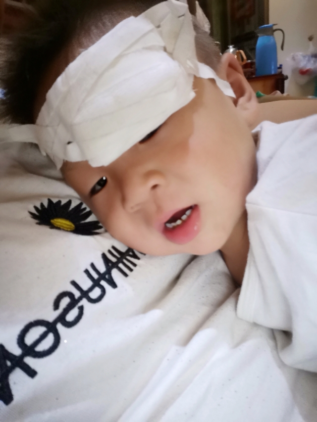 记录一个自责的妈妈，宝宝摔倒缝针，保佑不要留疤