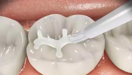 口腔治疗保险,口腔医疗责任保险