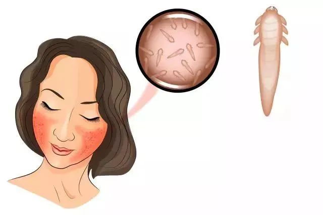 为什么下巴两侧脖子两侧频繁长痘,下巴长痘看中医好还是西医好