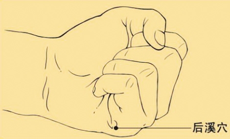 神经根型颈椎病治疗穴位,颈椎病艾灸哪个穴位最好