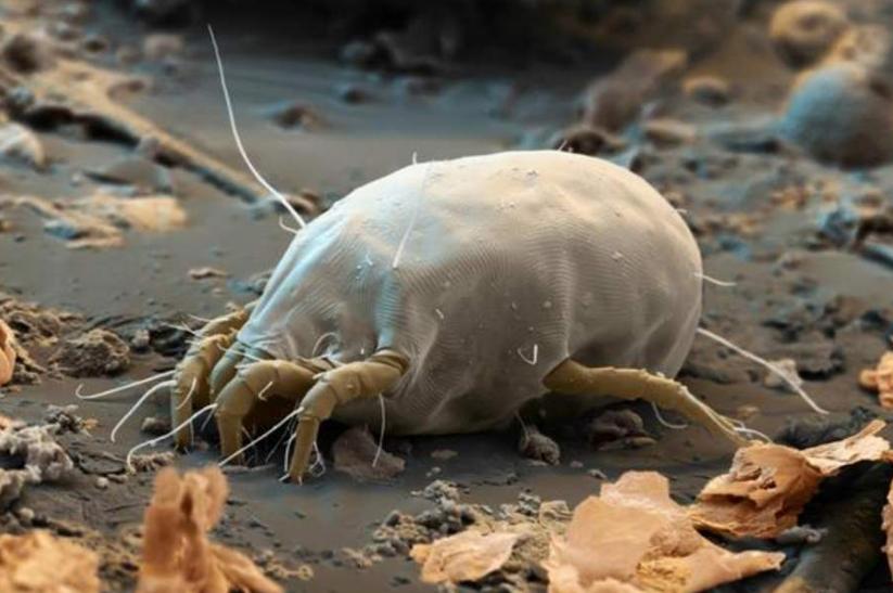 背部爆痘用什么药,背部长痘原因以及怎么调理