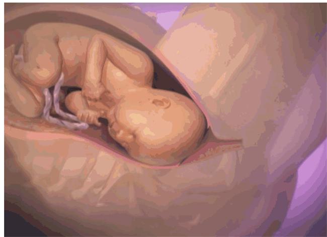 顺产痛不欲生就想从鬼门关走一趟,女人分娩如同鬼门关