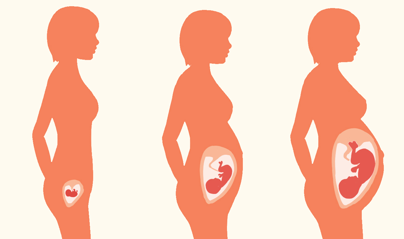 胎宝宝脐带绕颈是什么原因导致,胎宝宝脐带绕颈胎心会出现异常吗