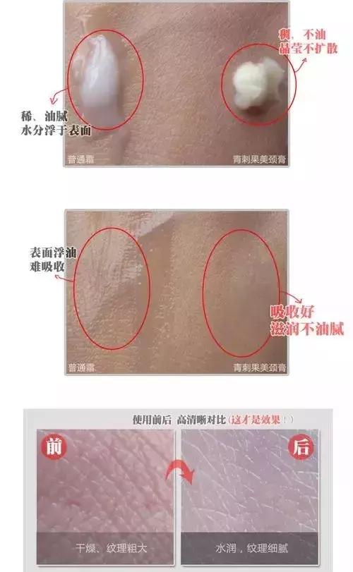 遗传颈纹怎么消除简单方法,消除颈纹最有效的瑜伽动作