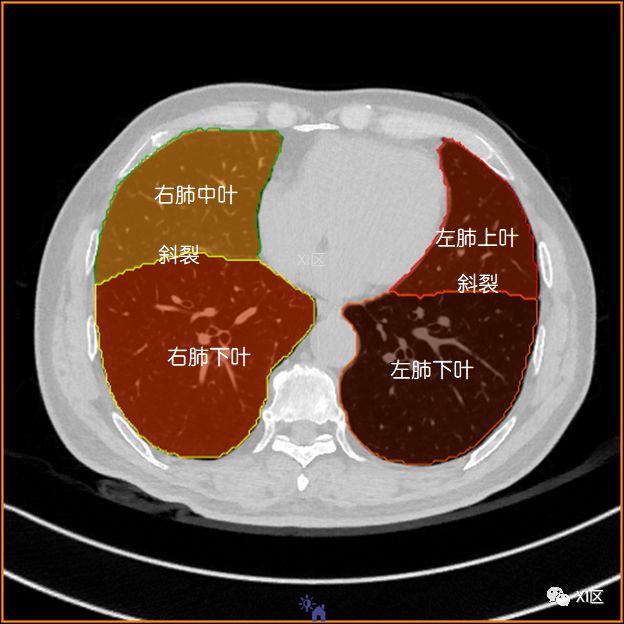 如此详细的肺部影像解剖，有点儿酷！