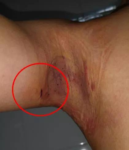 青岛第八人民医院全部科室,青岛第八人民医院皮肤科