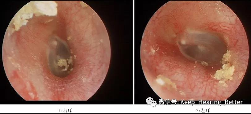 南大二附院,南大二附院耳鼻喉科专家