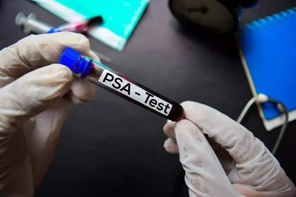 前列腺癌的症状吃什么食物,前列腺癌的寿命有几年