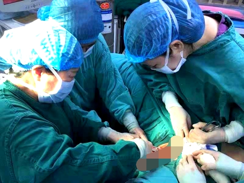 【脑医故事】妙手施术“拔掉”潜伏六年子宫肌瘤