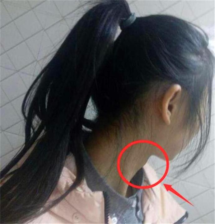 13岁女孩长胡子长喉结,女孩子长喉结长胡子正常吗