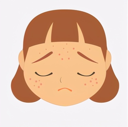 长青春痘怎么办10到13岁女生,长青春痘怎么办10到13岁