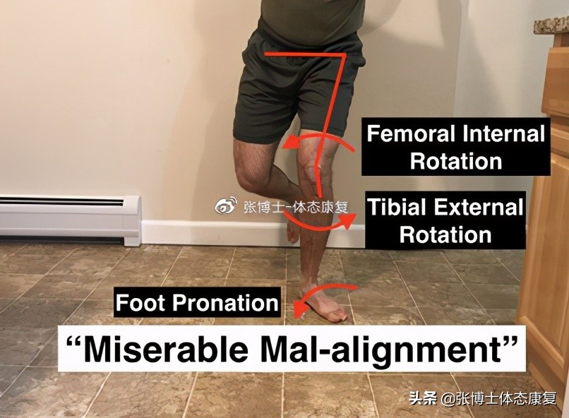 髌骨关节疼痛综合症怎么治,髌骨疼痛综合症的辅助疗法