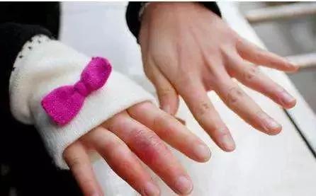 羽绒服干洗剂轻松解决,羽绒服干洗剂免洗家庭小妙招