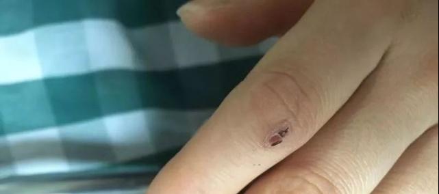 罕见毒蛇双头蛇,中国境内毒蛇双头蛇