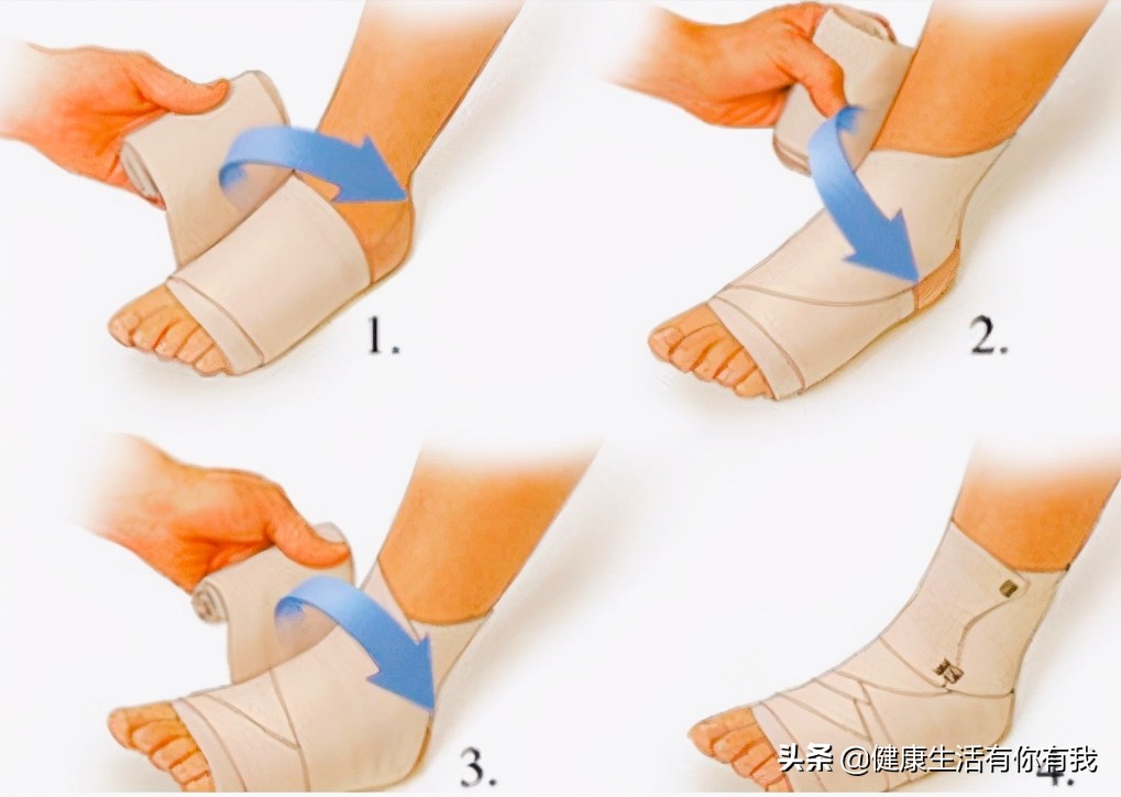 急性踝关节扭伤针灸特效穴,踝关节扭伤最新指南