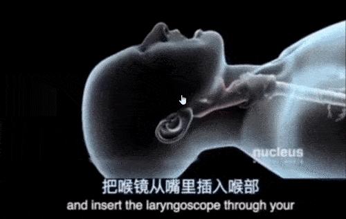 全球抢中国呼吸机视频,中国呼吸机紧缺性