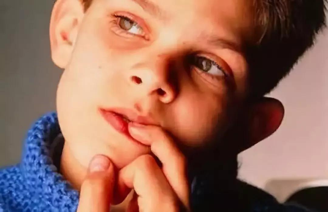 如何判断手上水泡是手癣还是疱疹,忍不住撕手指上的皮