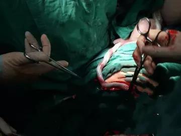 怀孕37周胎动突然剧烈频繁正常么,孕37周剧烈胎动持续半小时正常吗