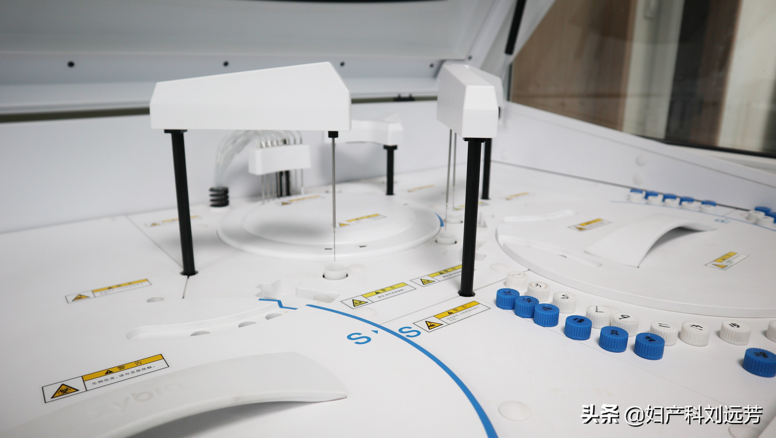 下面长疙瘩会不会是宫颈癌,身上长了小疙瘩会不会是宫颈癌