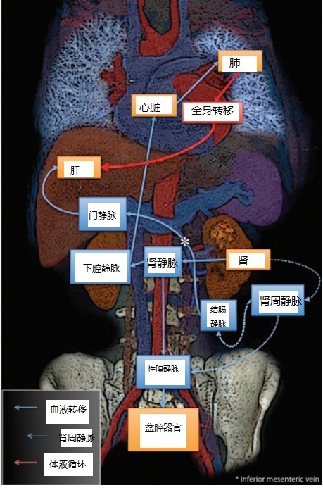 肺上考虑转移瘤是什么意思,肺转移瘤知识讲座