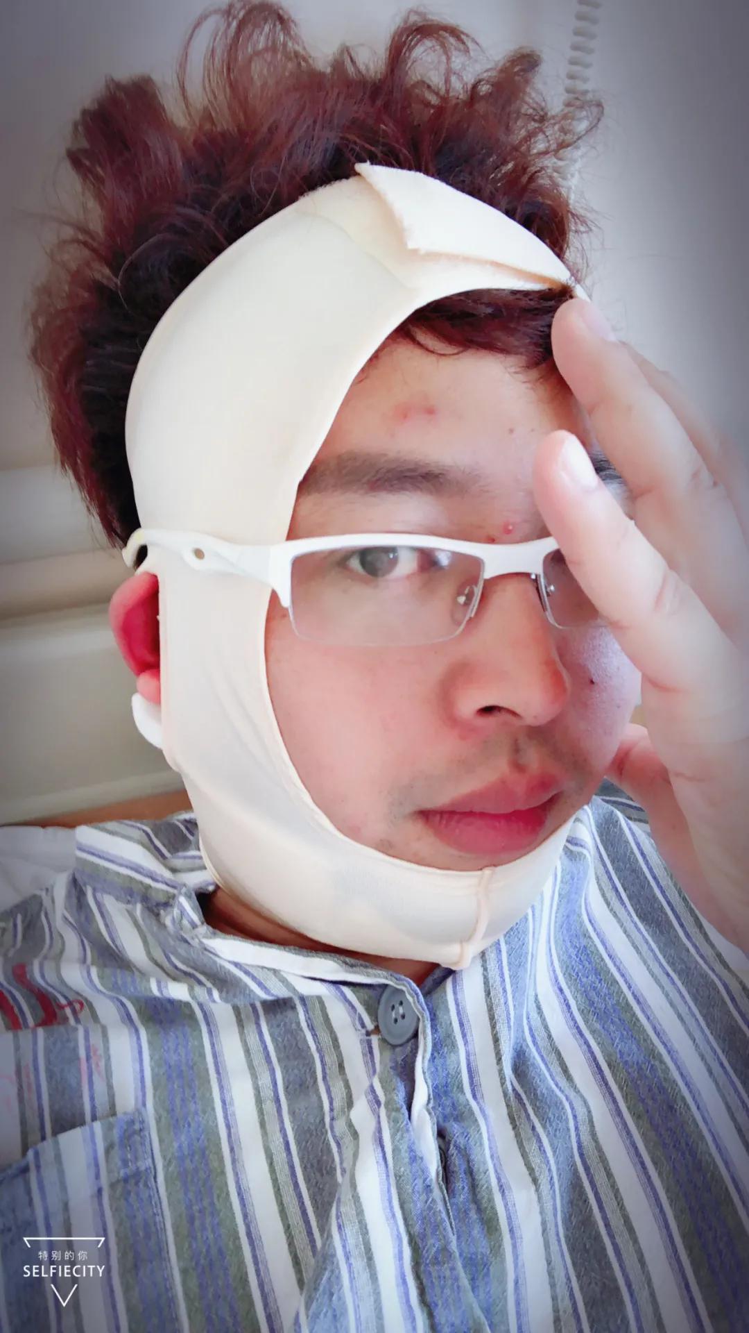 抽脂亲身经历回忆,抽脂血泪史