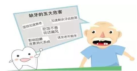 牙齿缺失多颗如何种牙,多颗牙齿缺失怎么种牙