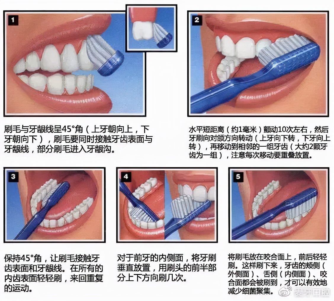 吃肉塞牙牙缝臭怎么办,总是塞牙牙缝臭