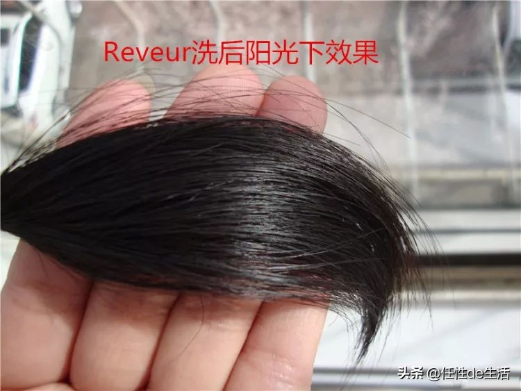 头皮油头发干枯脱发怎么办,脱发头皮干用什么洗发水最好