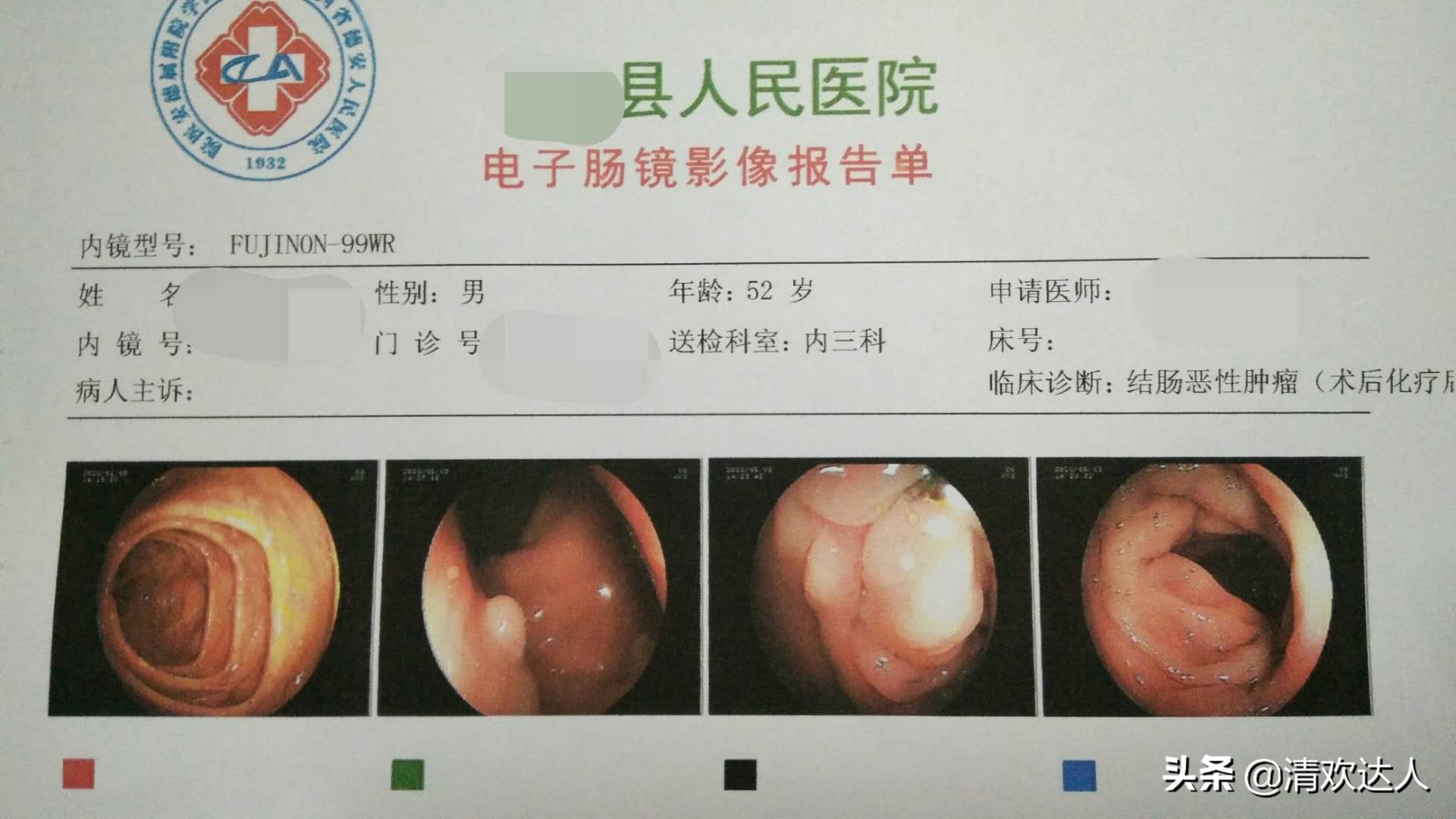 我的抗癌日记六十二,我的抗癌日记5