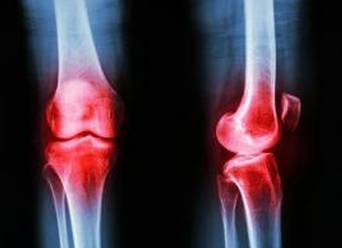 逛街逛久了膝盖特别痛怎么办,逛街多了腿疼是什么原因