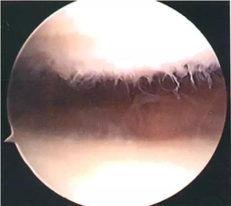 膝关节活动有响声应该看什么科室,膝关节活动有响声是怎么回事