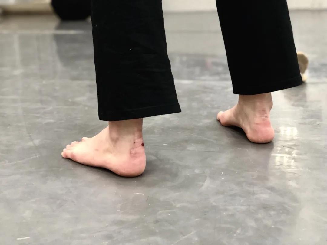 舞蹈如何快速提高软开度,舞蹈生怎么提高软开度