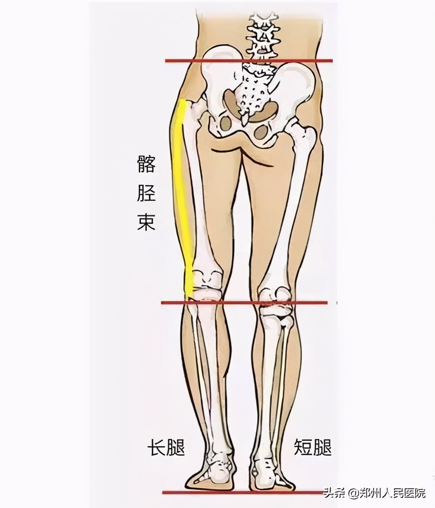 走路像鸭子一样摇摆,走路像鸭子的样子