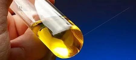 尿干化学分析结果蛋白质阴性,尿液镜检红细胞阴性表示什么