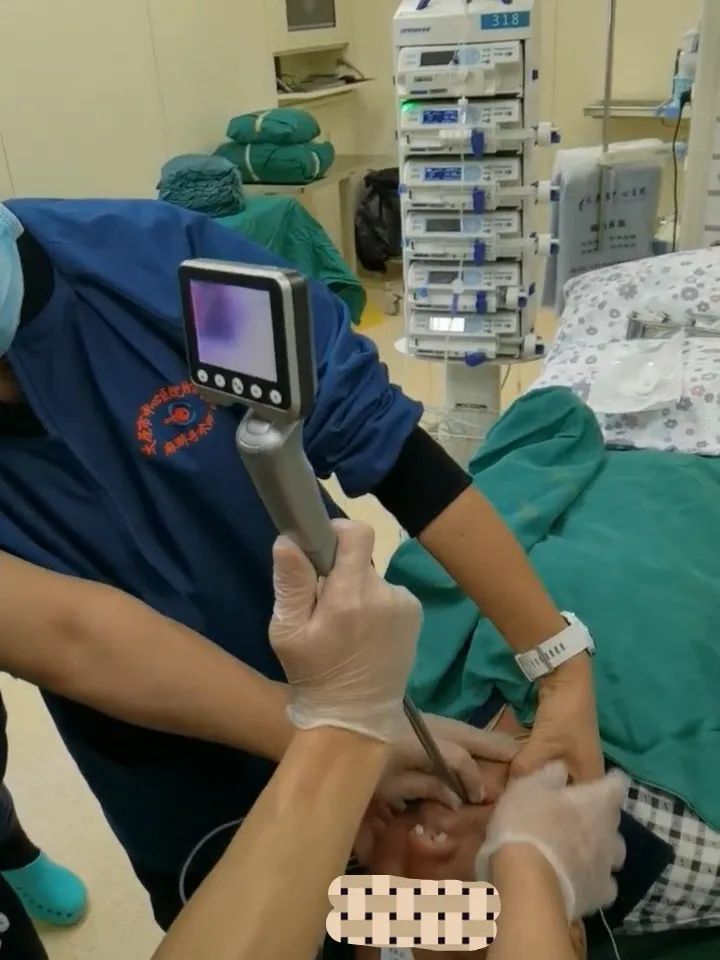 困难气道插管视频,困难插管