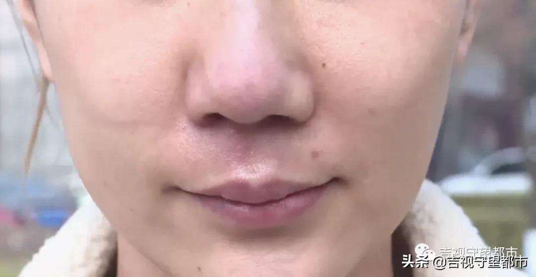 鼻综合三万块钱贵吗,一万块可以做鼻综合吗