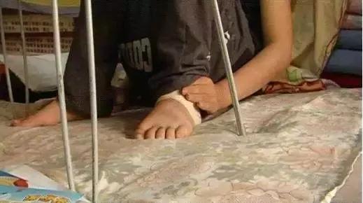 欧洲皇室病,欧洲皇室疾病