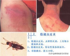 家居常见虫图片大全,家居虫类科普图文