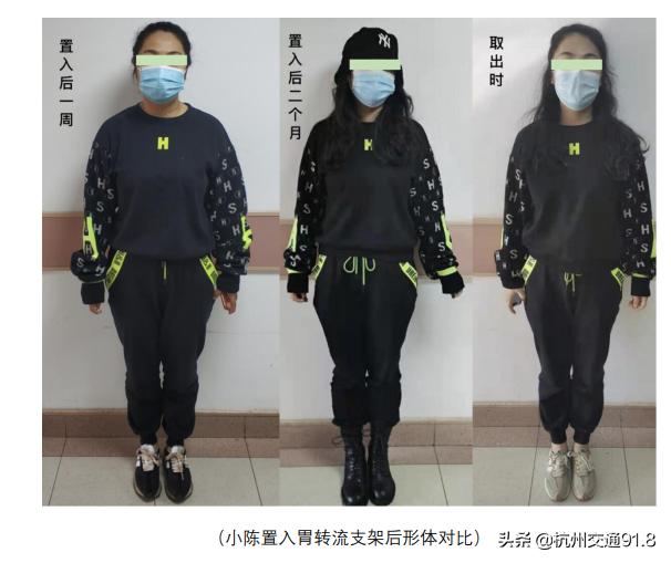 减肥黑科技项目,减肥运动快速燃脂黑科技