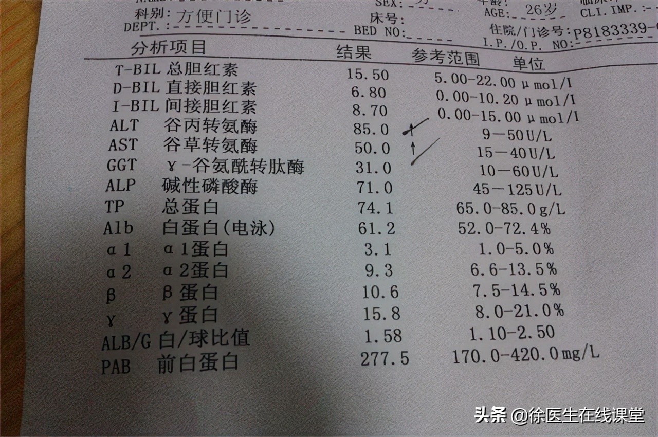 谷草转氨酶和谷丙转氨酶高会怎样,谷草转氨酶500谷丙转氨酶1800